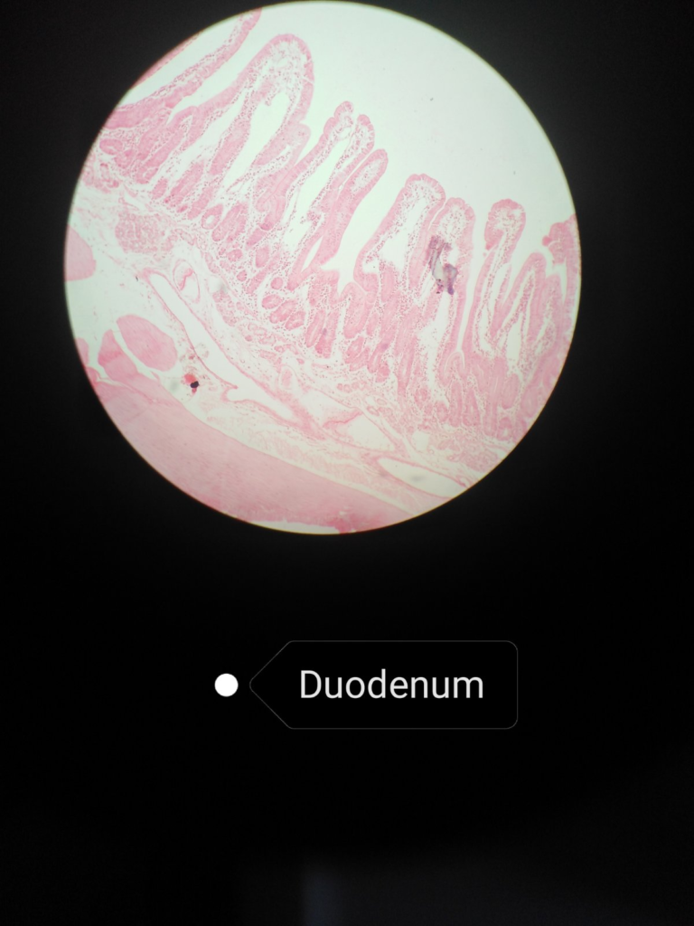 Microscopy of the duodenum