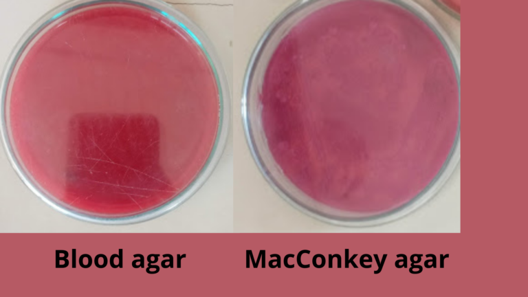 Staphylococcus aureus