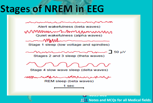 stages of NREM sleep