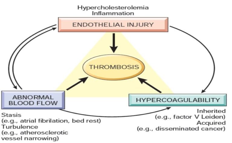 thrombosis