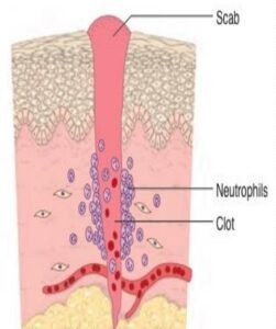 wound healing