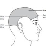extent of scalp