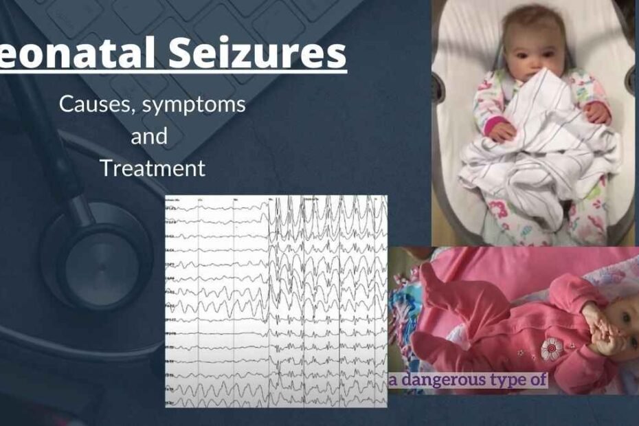 Neonatal Seizures