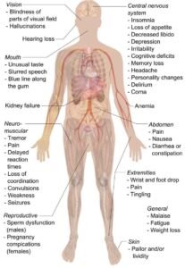 lead poisoning